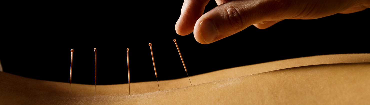 Acupuncture Chicago